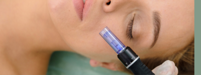microneedling en suisse