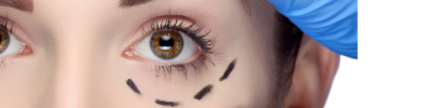 lifting sourcil